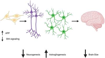 Astrocytes in Down Syndrome Across the Lifespan